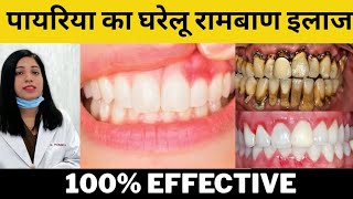 पायरिया का घरेलु इलाज | Pyorrhea Treatment At Home | Home Remedies For Periodontitis