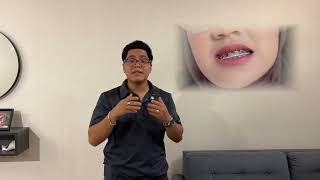 Ligas para Brackets que te harán llorar de dolor😭