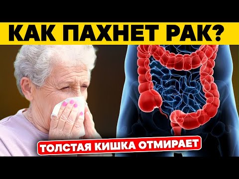 10 Тревожных Признаков Поражения Толстой Кишки – Спасите Себя!