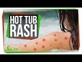 Health Risks Associated with Hot Tubs