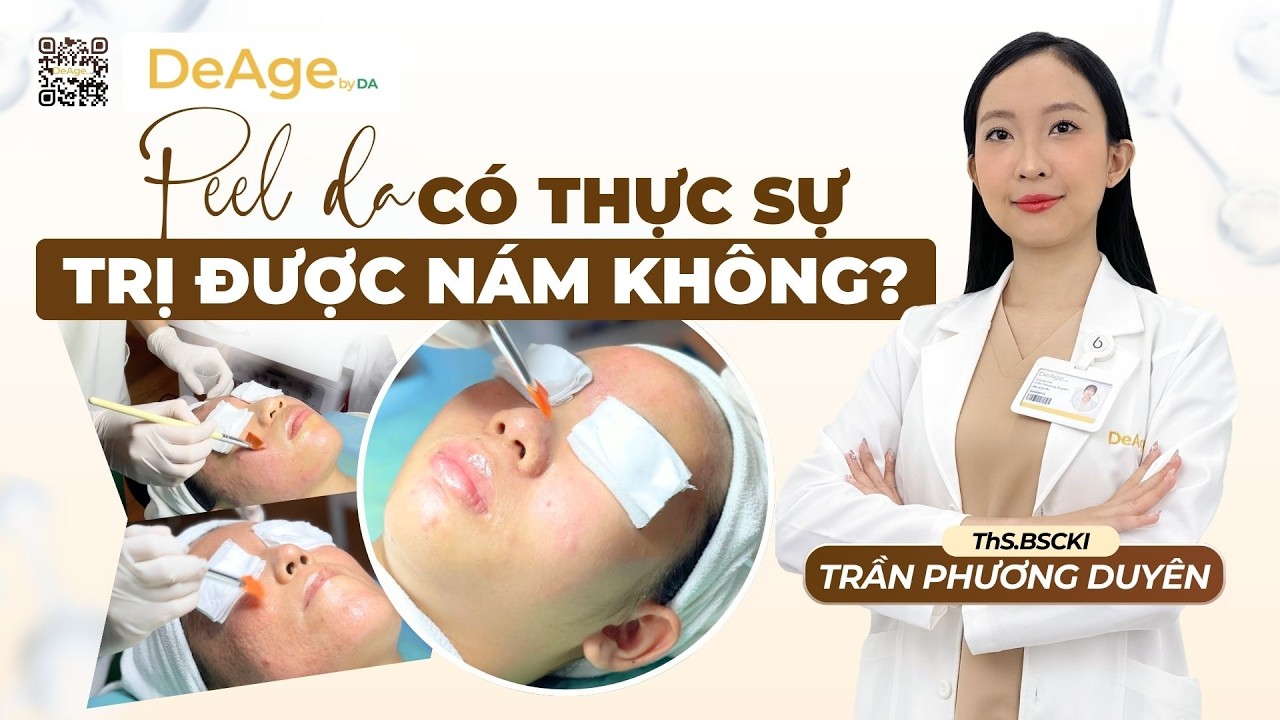 Nám da thai kỳ: làm sao để ngăn ngừa và điều trị an toàn cho bà bầu 9
