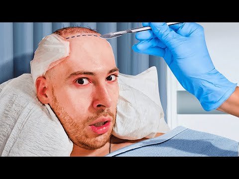 My Life Changing Hair Transplant in Turkey