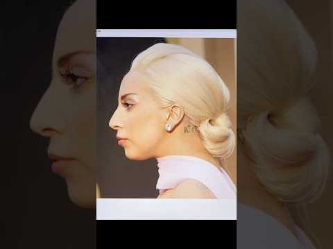 Lady Gaga with Hyperpigmentation face #ladygaga #hyperpigmentation #makeover #makeup #growup #art