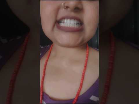 इस विधि को करने से पीले दांत हो जायेंगे एक दम सफेद 💯% ... #shortvideo #explorepage #teethwhitening