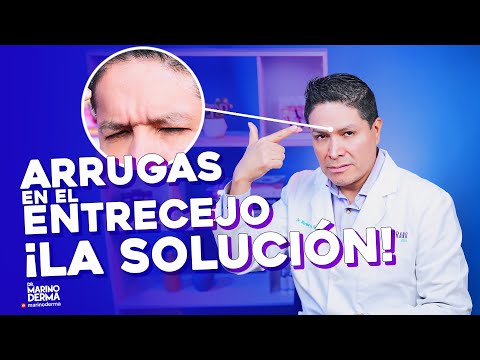 ARRUGAS EN EL ENTRECEJO ¿CÓMO SOLUCIONARLAS?