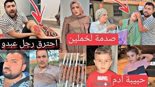 صدمة جديدة قبل العرس لخملين//آدم عشقان💖//احترق رجل عبدو 😢//كباب مشوي عالفحم😋