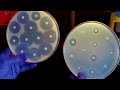 Antibiotic Resistance and Stewardship