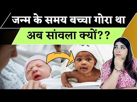 जन्म के समय मेरे बच्चे का रंग गोरा था लेकिन अब सांवला होता जा रहा है | Reasons of skin darkness