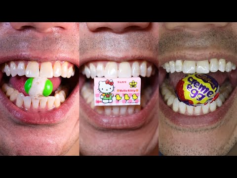 Satisfying Chewing ASMR #Compilation #ASMR #DoctorTristanPeh