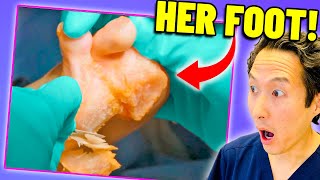 Masses Won't Stop Growing! Doctor Reacts to MY FEET ARE KILLING ME!