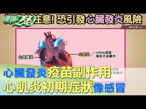 心臟發炎疫苗副作用 心肌炎初期症狀像感冒 健康2.0