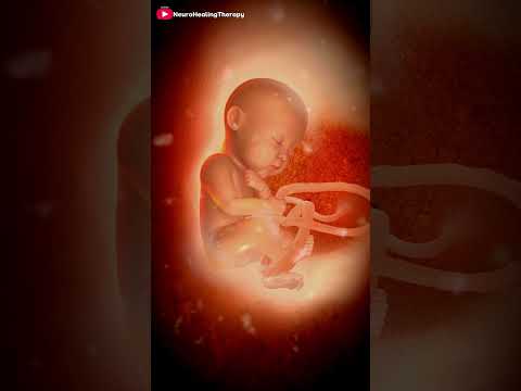 Cesarean Baby Delivery 3D Animation #shorts