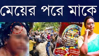 পুলিশের লাঠি কপালে: অভয়ার মাকে মেরে নির্লজ্জতা বজায় শাসকের - প্রশ্ন কেন শুভেন্দুর দায়িত্ব নিয়েও?
