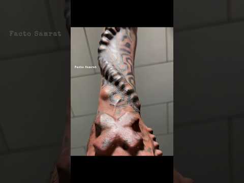 😱 "When Tattoo Is Not Enough… They Put Iron Inside Skin!" — যখন ট্যাটুতে মন ভরে না, তখন শরীরে ঢুকে