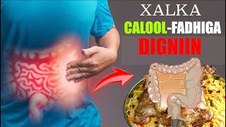 Maxaa keena Calool xirinka ( calool istaaga badan )