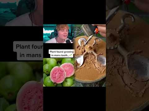 The STRANGEST Things Found Inside Human Body! 😱