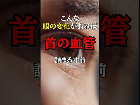 放置厳禁！知らないと後悔する「首」の血管が詰まる直前の眼の危険サイン#医師#脳梗塞#予防医学チャンネル