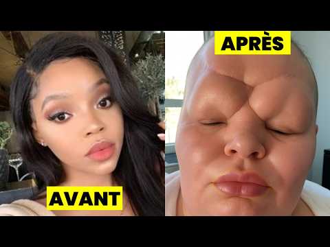 10 célébrités africaines détruites par la chirurgie