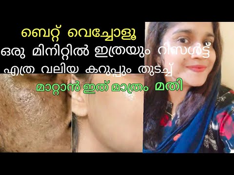 ഒരു മിനിറ്റിൽ ഇത്രയും റിസൾട്ട് 😳😳😱Skin whitening face cream #malayalam #skinwhitening