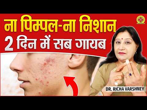 Acupressure Points For Pimples And Dark Spots