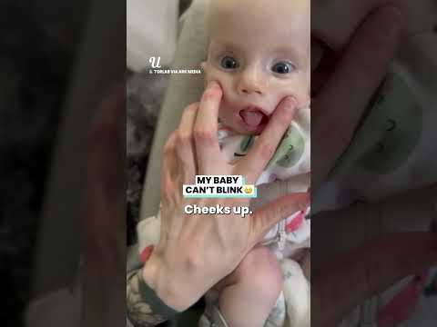 My Baby Can't Blink#viralvideo #babies #parenting #viral