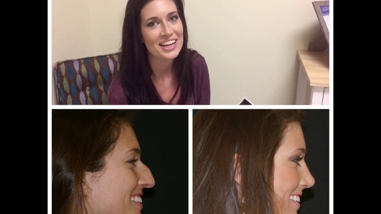 Woman speaking, three images with varying expressions.