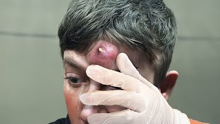 WHY did he squeeze it..