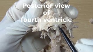 Posterior view of fourth ventricle
