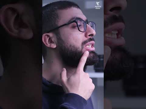 نصائح علاج مفصل الفك -  تعديل وضع الأسنان