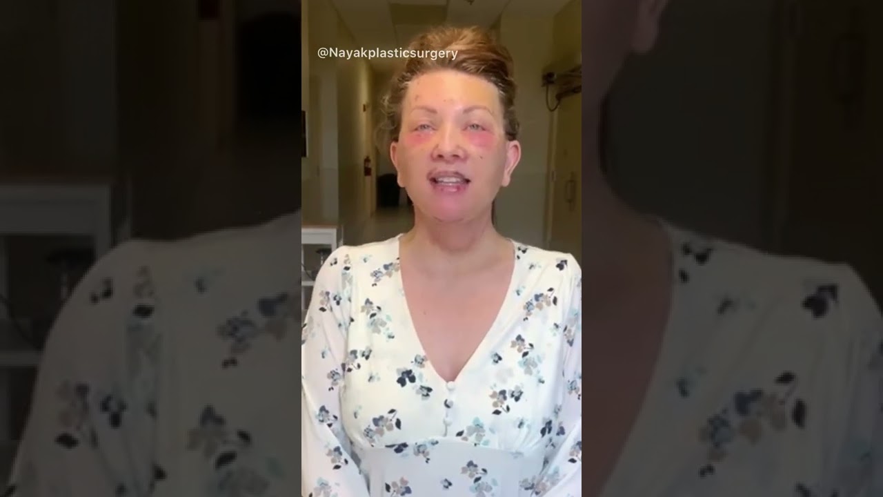 Woman showing post-surgery recovery progress.