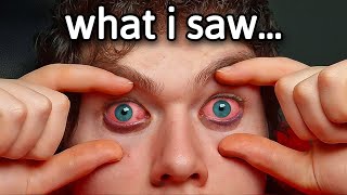I Stayed Awake for 11 Days (world record)