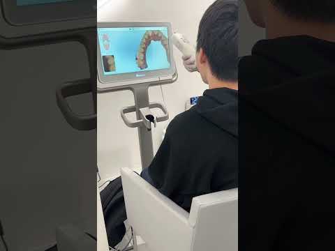 マウスピース矯正
