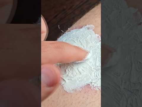 Как избавиться от укуса тарантула.