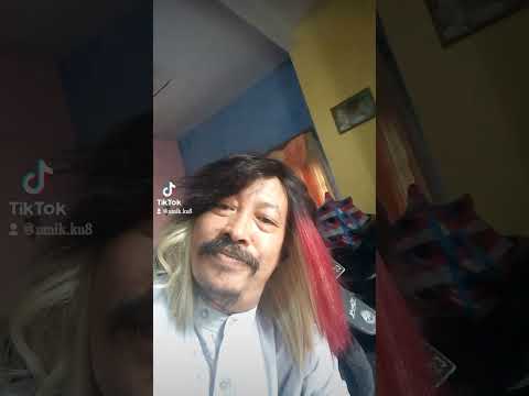 Wig Rambut Penutup Botak Rahmad Yulianto Menyala Bosque