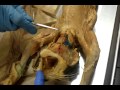 Muscles of the Neck and Throat