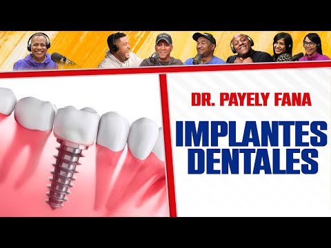 Todo sobre LOS IMPLANTES DENTALES - DR. Payely Faña