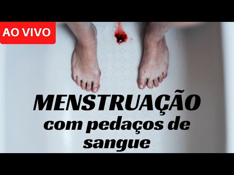 Mentruação com pedaços de sangue: o que pode ser? | Dr. Michel Palheta
