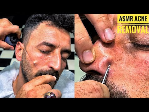 ASMR SLEEP MASSAGE  • Acne Removal and feather cleaning