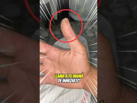 ¡Se despertó con cortes en la mano! 😨🩸