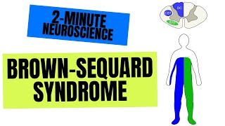 2-Minute Neuroscience: Brown-Séquard Syndrome