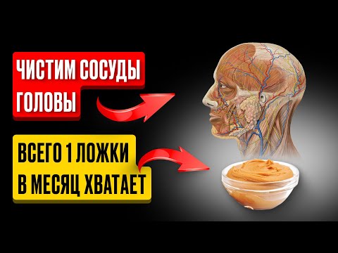 Раньше врачи ЧИСТИЛИ СОСУДЫ ГОЛОВЫ обычным... Одна ложка в месяц и сосуды чистые