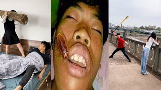 You Won't Be Able To Stop Laughing When You Watch This Video - Funniest Video Compilation 2024 #609