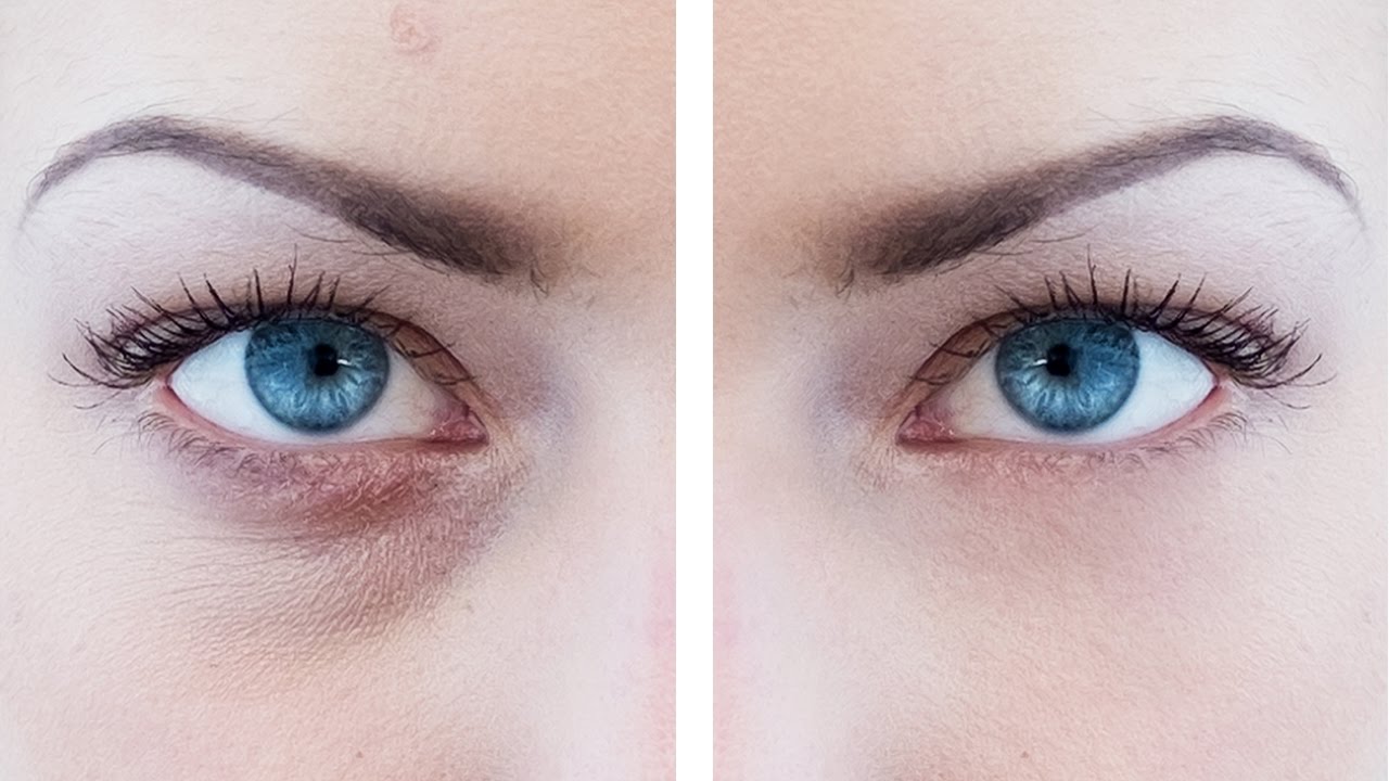 How to Remove Eye Bags in Photoshop