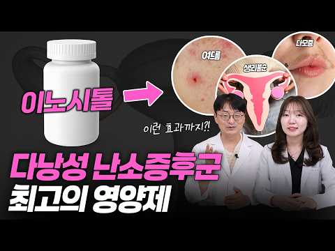 여드름, 생리불순, 다모증의 원인 ‘다낭성 난소 증후군’ 이거 하나면 됩니다 (다이어트, 임신 영양제)
