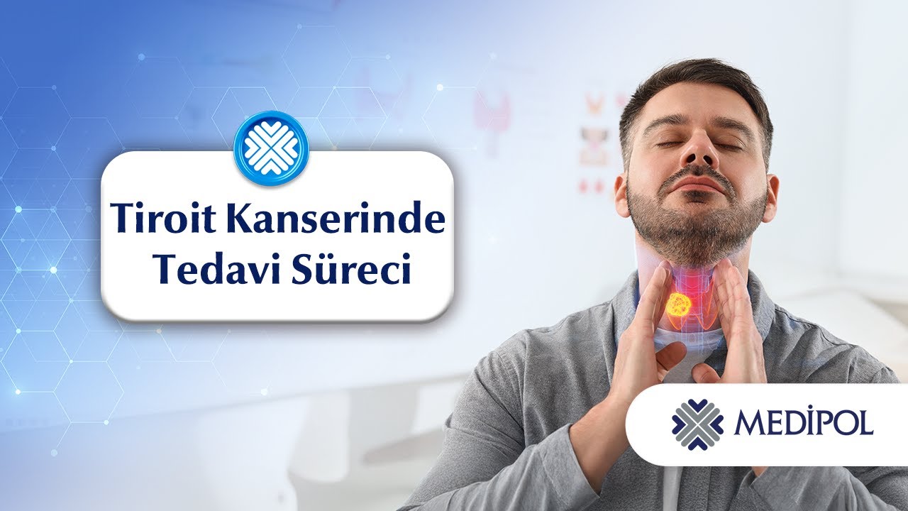 Tiroit Kanserinde Tedavi Süreci Nasıl Olmaktadır?