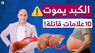 تحذير ⚠️ 10 علامات خطيرة تدل على موت الكبد والعلاج الطبيعي المنقذ