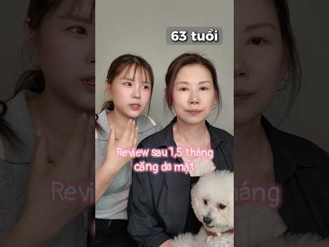 Sau 1,5 tháng căng <strong>da</strong> mặt… Có tự nhiên không? ✨ #review