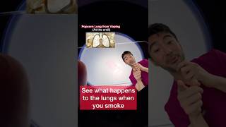 See What Smoking Does to Your Lungs