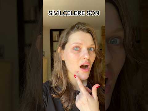 SİVİLCEYİ 1 GECEDE GEÇİREN MUCİZEVİ KREM?  #shorts #ciltbakımı #cilttemizliği #nightroutine