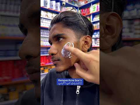 Glow & Clean Anti Acne Cream #ameenbeautytips @GlowAndCleanByAmeen